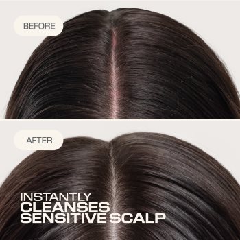 Goldwell Dualsenses Scalp Specialist Sensitive Foam Shampoo sampon spuma pentru piele sensibila